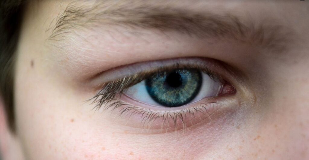 Ever heard of “eyebrow dandruff”?