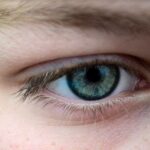 Ever heard of “eyebrow dandruff”?