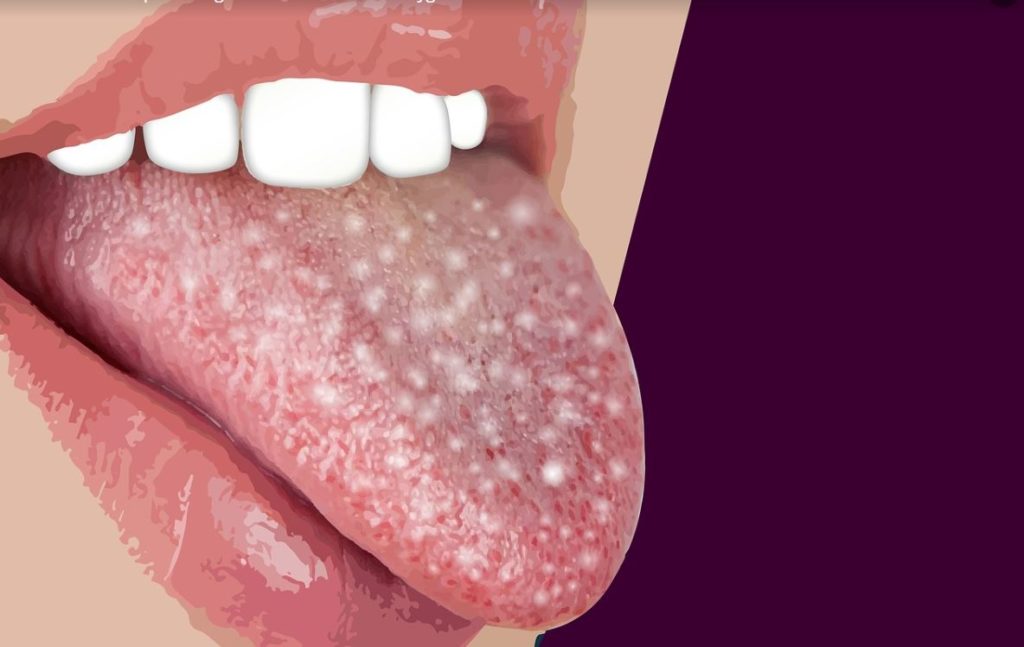 Mechanical Detox Every Morning 2 tongue2
